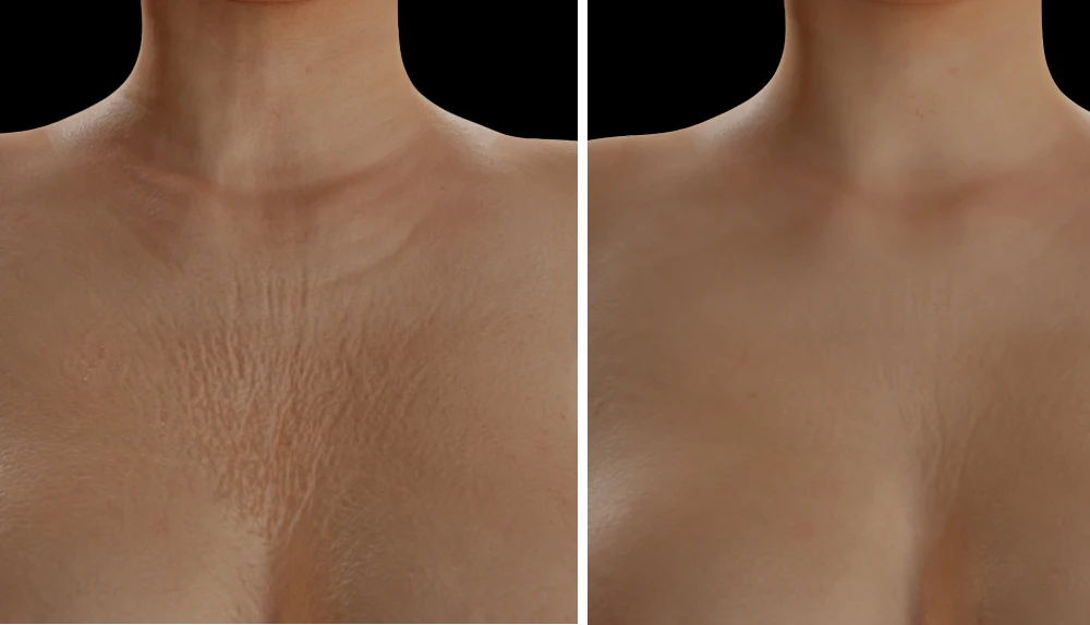 Traitement pour visage