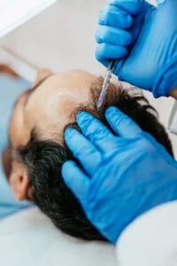 Cléoderm traitement pour calvitie et perte de cheveux